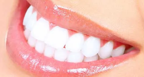 Teeth Whitening Novi Michigan